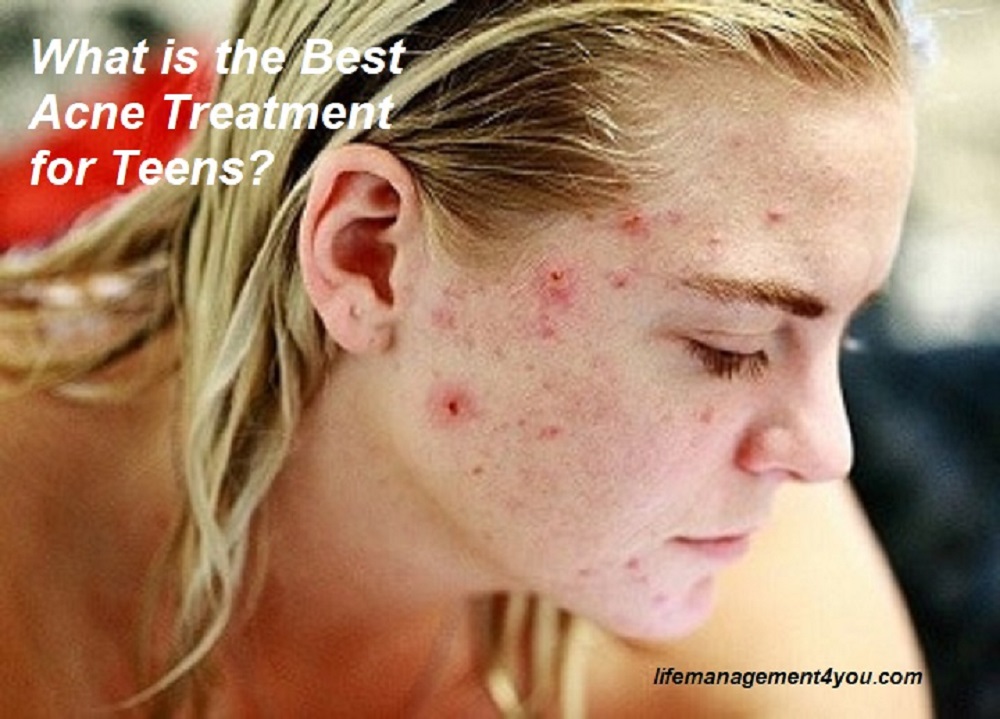 What is the Best Acne Treatment For Teens What is the Best Acne Treatment For Teens